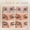 Elevate Your Gaze: The Beauty of Eyelid Lifter Strips